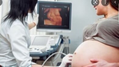 sonography
