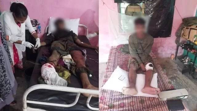 निर्वाचन ड्यूटी के दौरान नक्सली वारदात में बस्तर फाइटर्स के दो घायल जवानों को दी जा रही है 15-15 लाख रूपए की अनुग्रह राशि 1 images 18 1