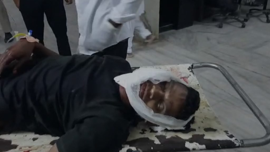 जिला अस्पताल एसी में रिपेयरिंग के दौरान हादसा : गैस कैन फटने से अफरा-तफरी, मैकेनिक बुरी तरह से झुलसा 1 image 97 4 1024x576 1