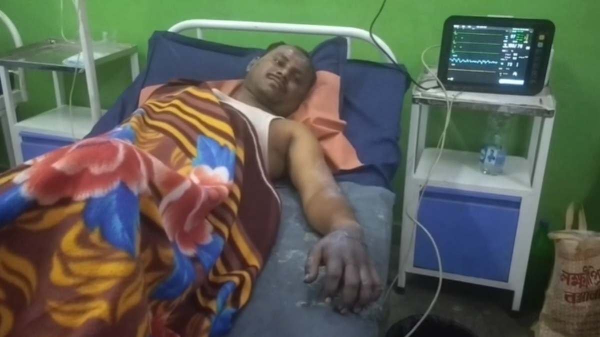 उरला-बोरझरा औद्योगिक क्षेत्र में फिर हादसा: सपना स्टील फैक्ट्री में श्रमिक गंभीर रूप से झुलसा 1 image 2025 10 15T184947.908