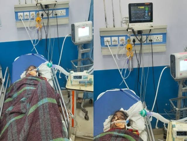 Two women cooks on strike in Raipur die during treatment 1 images 27 1