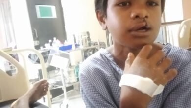 15 साल तक कटे होंठ-तालु से जूझता रहा बच्चा: 'चिरायु' दल ने कराया मुफ्त ऑपरेशन, चेहरे पर लौटी मुस्कान 4 IMG 20260703 WA0310